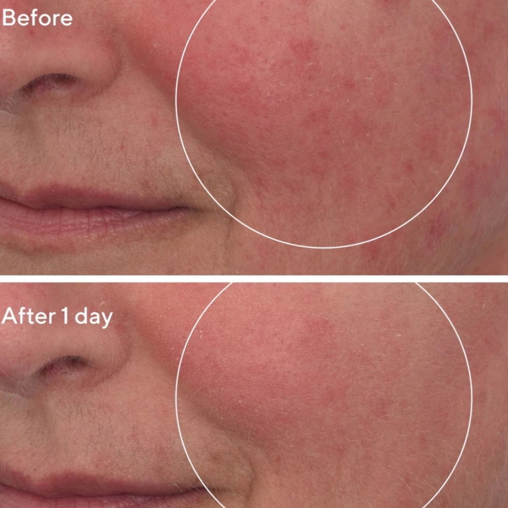 Murad Hydration Cellular Hydration Repair Mask, 10ml (Travel Size), NIB - Picture 5 of 5